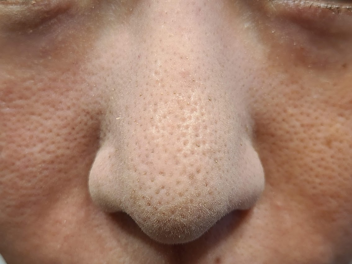エトヴォスマットスムースミネラルファンデーション鼻の毛穴