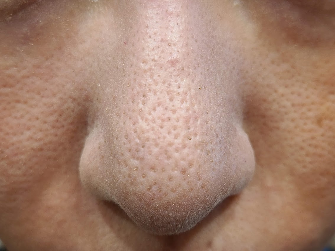 ナチュラグラッセルースパウダー鼻の毛穴