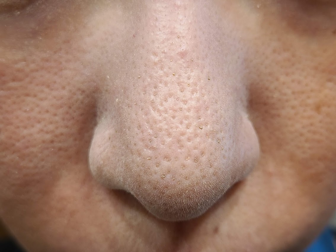 レイチェルワインミネラルファンデーション鼻の毛穴